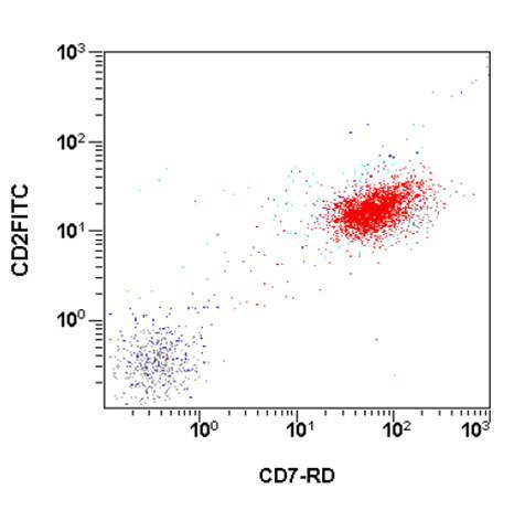 Flow cytometry of mediastinal mass FNA